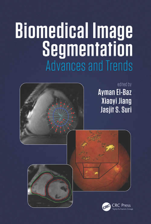 Book cover of Biomedical Image Segmentation: Advances and Trends