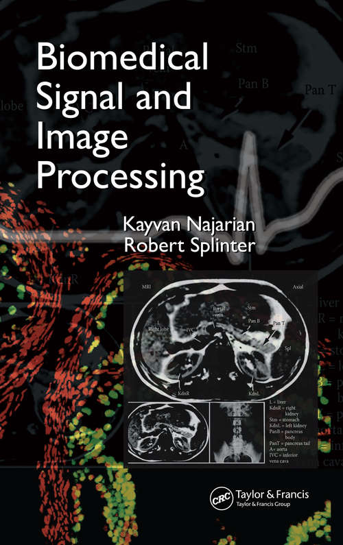 Book cover of Biomedical Signal and Image Processing