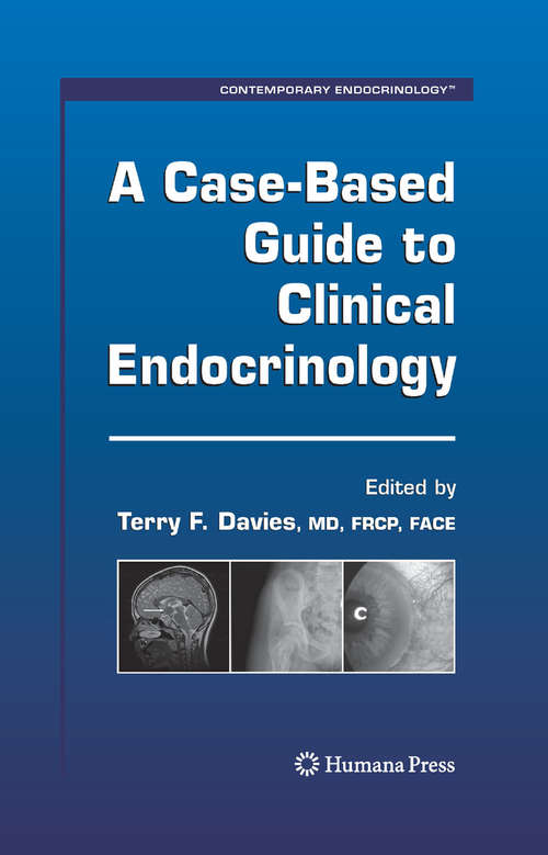 Book cover of A Case-Based Guide to Clinical Endocrinology (2008) (Contemporary Endocrinology)