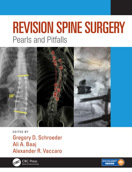 Book cover of Revision Spine Surgery: Pearls and Pitfalls