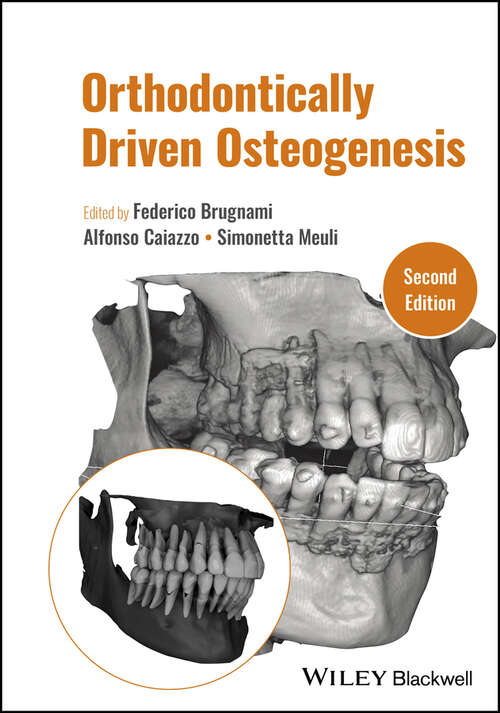 Book cover of Orthodontically Driven Osteogenesis