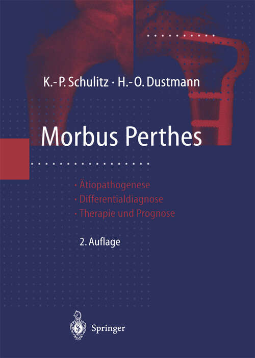 Book cover of Morbus Perthes: Ätiopathogenese, Differentialdiagnose, Therapie und Prognose (2. Aufl. 1998)