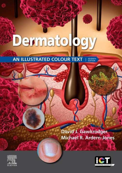 Book cover of Dermatology E-Book: An Illustrated Colour Text (6) (Illustrated Colour Text)