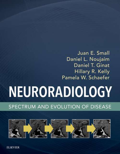 Book cover of Neuroradiology: Spectrum and Evolution of Disease