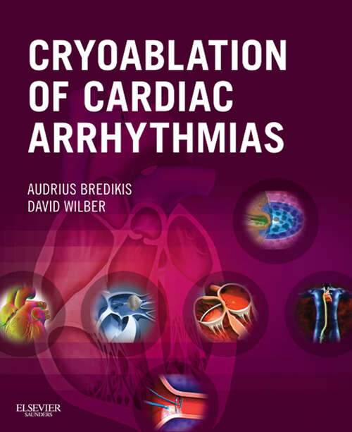 Book cover of Cryoablation of Cardiac Arrhythmias