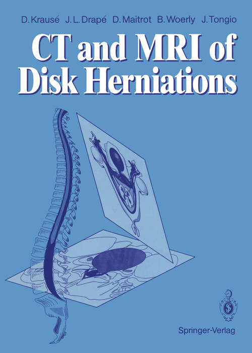 Book cover of CT and MRI of Disk Herniations (1991)