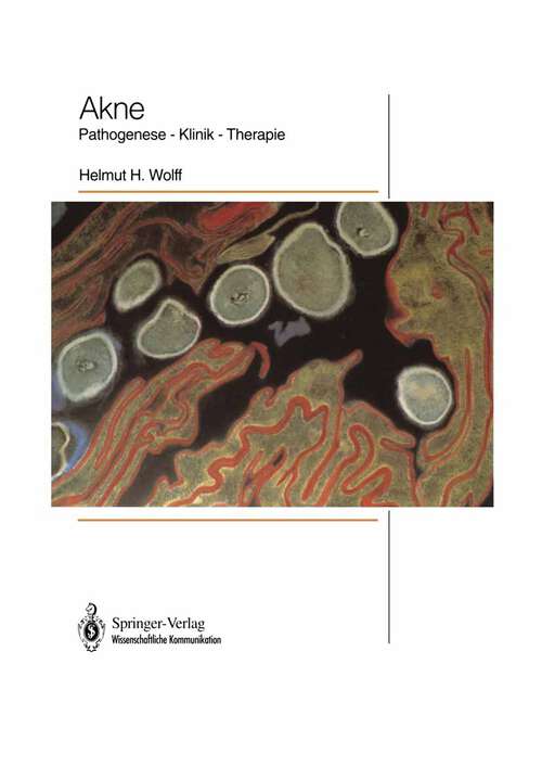 Book cover of Akne: Pathogenese — Klinik — Therapie (1992)