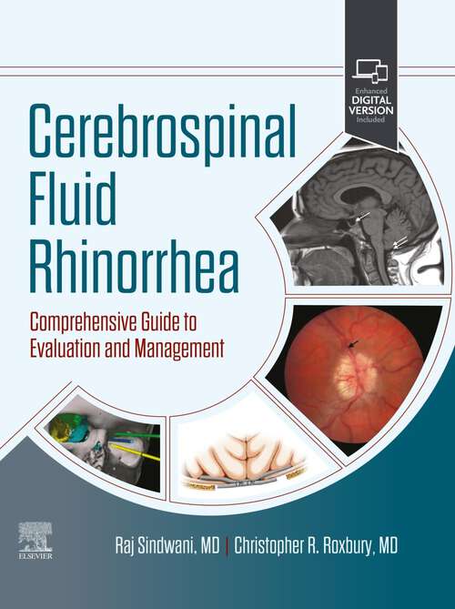 Book cover of Cerebrospinal Fluid Rhinorrhea - E-Book: Comprehensive Guide to Evaluation and Management