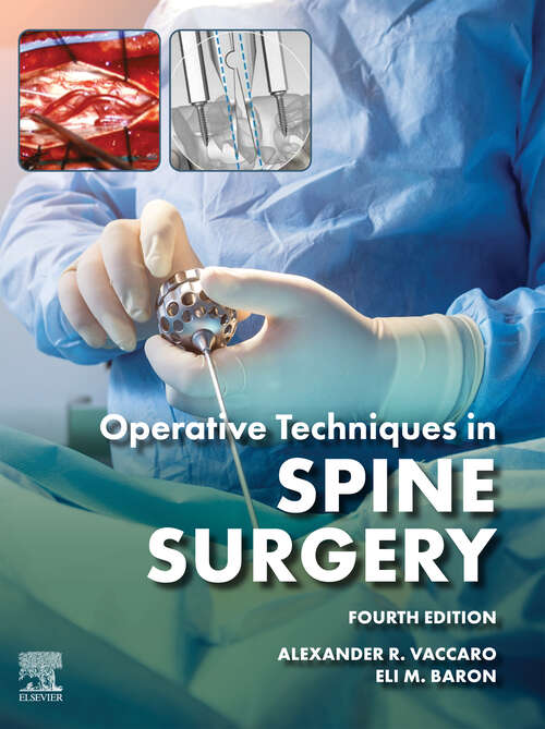 Book cover of Operative Techniques: Expert Consult: Online (2) (Operative Techniques)