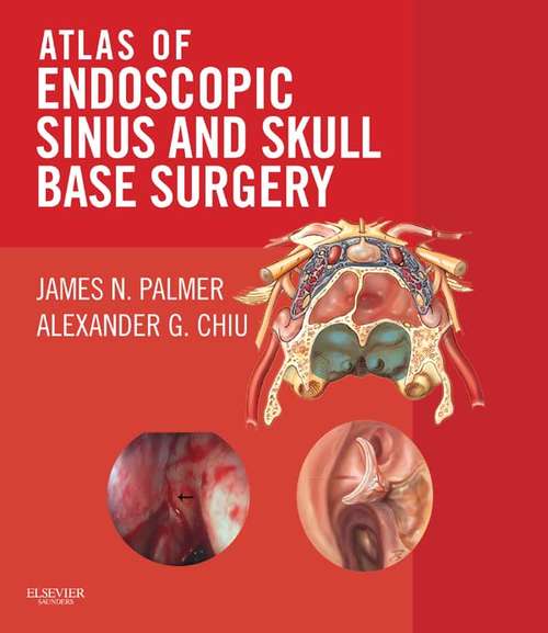 Book cover of Atlas of Endoscopic Sinus and Skull Base Surgery E-Book: Expert Consult - Online And Print (2)