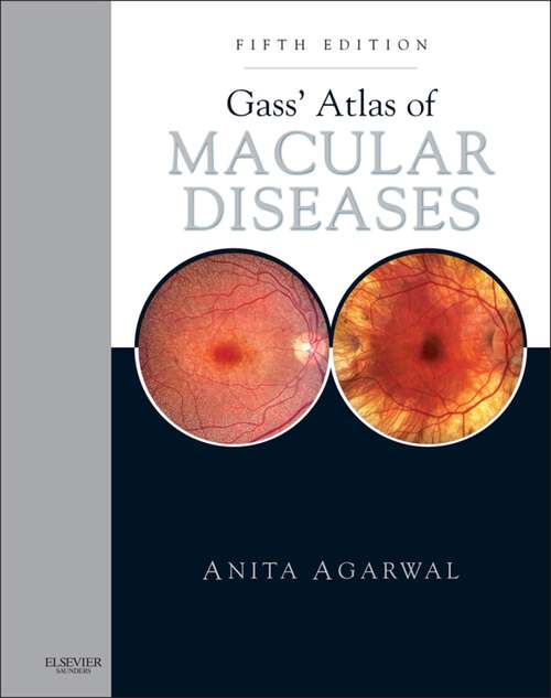 Book cover of Gass' Atlas of Macular Diseases E-Book: 2-Volume Set - Expert Consult: Online and Print (5)