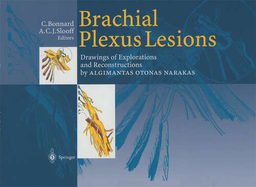 Book cover of Brachial Plexus Lesions: Drawings of Explorations and Reconstructions by Algimantas Otonas Narakas (1999)