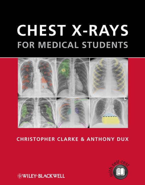 Book cover of Chest X-rays for Medical Students