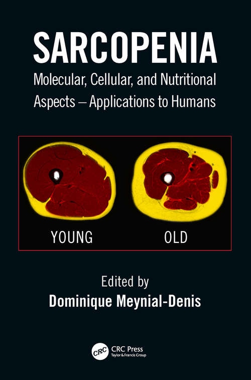 Book cover of Sarcopenia: Molecular, Cellular, and Nutritional Aspects