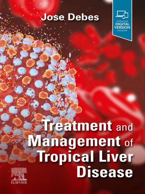 Book cover of Treatment and Management of Tropical Liver Disease - E-Book