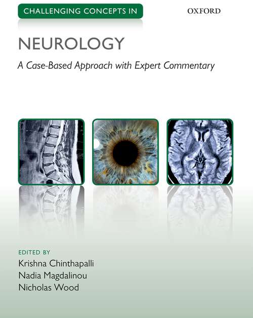 Book cover of Challenging Concepts in Neurology: Cases with Expert Commentary (Challenging Cases)