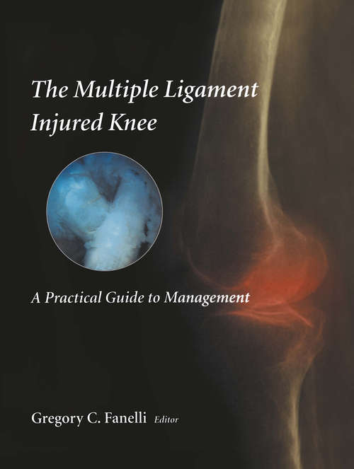 Book cover of The Multiple Ligament Injured Knee: A Practical Guide to Management (2004)