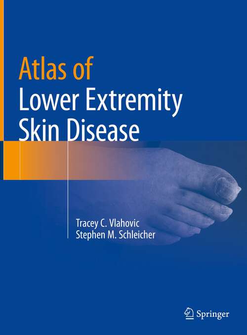 Book cover of Atlas of Lower Extremity Skin Disease (1st ed. 2022)