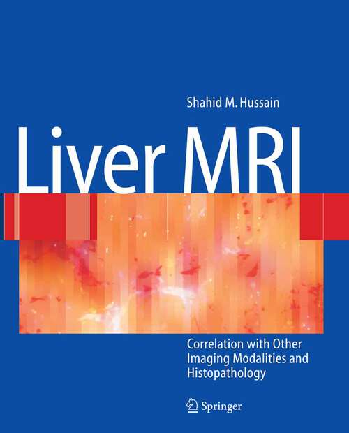 Book cover of Liver MRI: Correlation with other Imaging Modalities and Histopathology (2007)