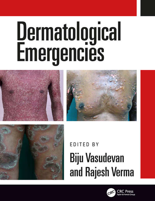 Book cover of Dermatological Emergencies