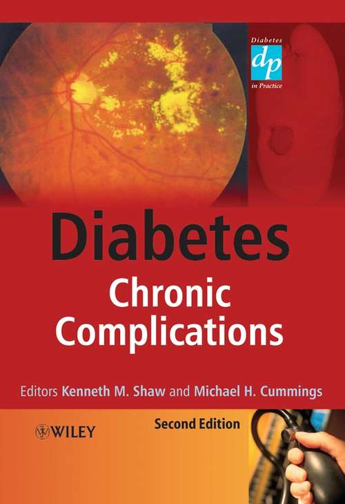 Book cover of Diabetes: Chronic Complications (2) (Practical Diabetes #16)