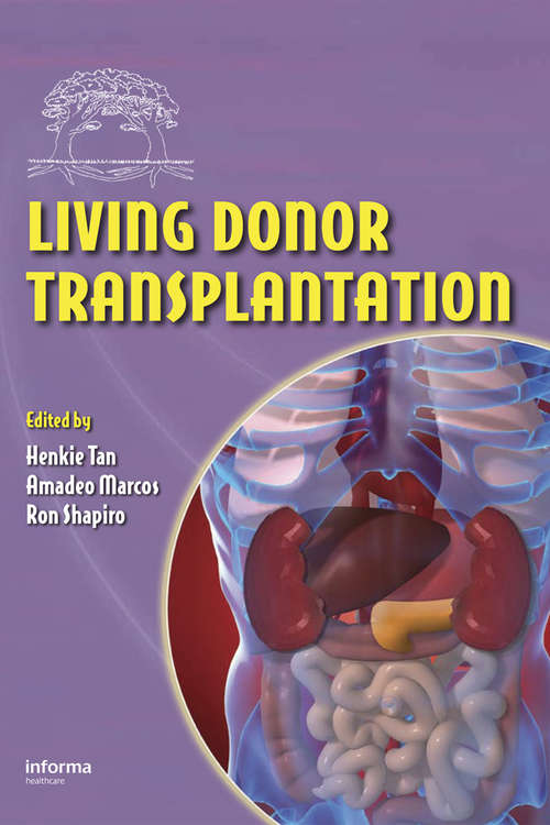 Book cover of Living Donor Transplantation