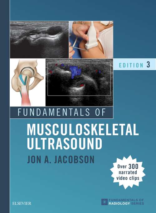 Book cover of Fundamentals of Musculoskeletal Ultrasound E-Book: Fundamentals of Musculoskeletal Ultrasound E-Book (3) (Fundamentals of Radiology)