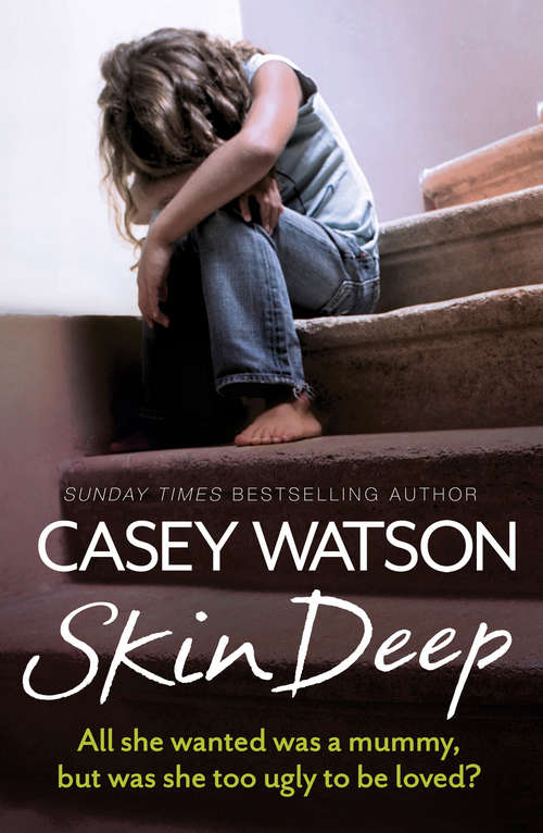 Book cover of Skin Deep: All She Wanted Was A Mummy, But Was She Too Ugly To Love? (ePub edition)