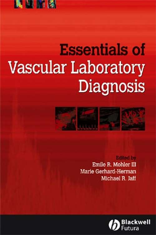 Book cover of Essentials of Vascular Laboratory Diagnosis