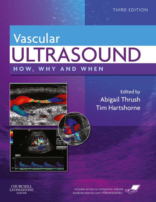 Book cover of Vascular Ultrasound: How, Why and When (3) (How, Why and When)