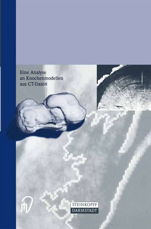 Book cover of Die Calcaneusfraktur: Eine Analyse an Knochenmodellen aus CT-Daten (1999)