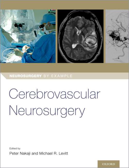 Book cover of Cerebrovascular Neurosurgery (Neurosurgery by Example)