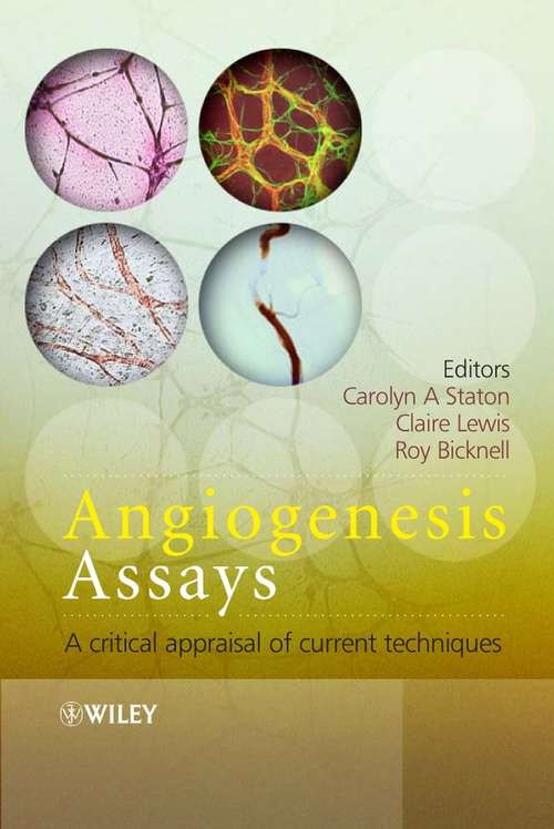 Book cover of Angiogenesis Assays: A Critical Appraisal of Current Techniques