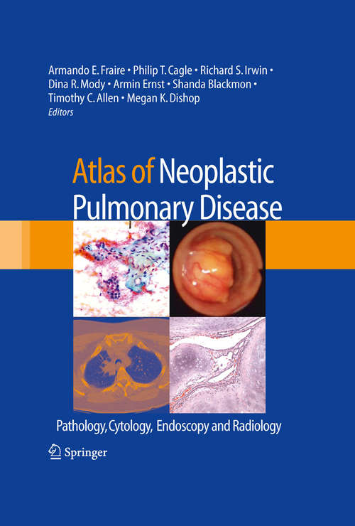 Book cover of Atlas of Neoplastic Pulmonary Disease: Pathology, Cytology, Endoscopy and Radiology (2010)