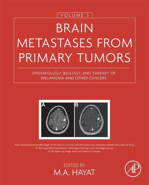 Book cover of Brain Metastases from Primary Tumors, Volume 3: Epidemiology, Biology, and Therapy of Melanoma and Other Cancers