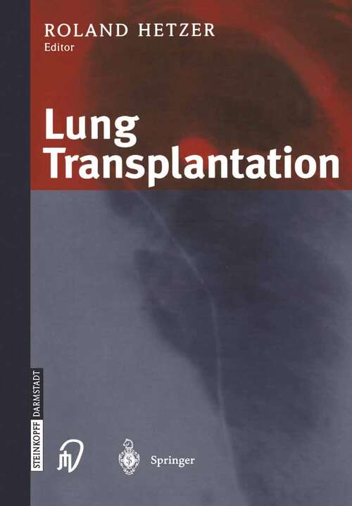 Book cover of Lung Transplantation (2003)