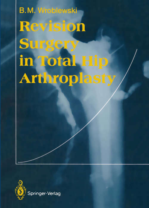 Book cover of Revision Surgery in Total Hip Arthroplasty (1990)