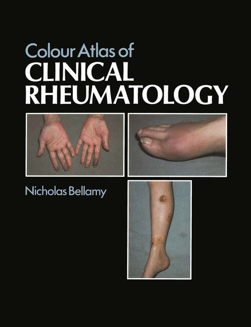 Book cover of Colour Atlas of Clinical Rheumatology (1985)
