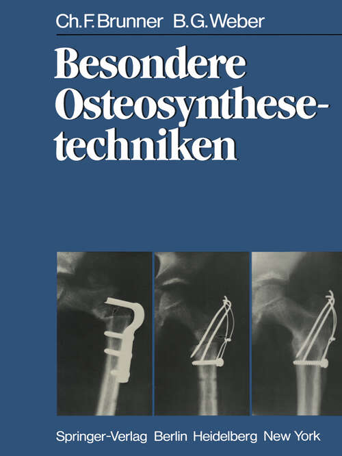 Book cover of Besondere Osteosynthesetechniken (1981)