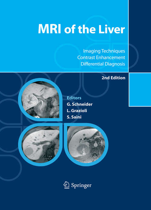 Book cover of MRI of the Liver: Imaging Techniques, Contrast Enhancement, Differential Diagnosis (2nd ed. 2006)