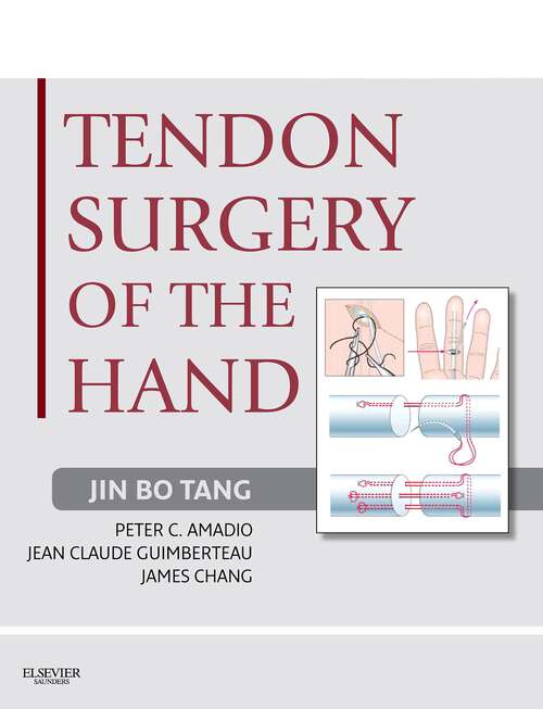 Book cover of Tendon Surgery of the Hand E-Book: Expert Consult - Online and Print