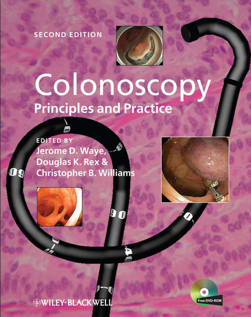 Book cover of Colonoscopy: Principles and Practice