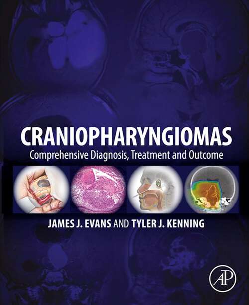 Book cover of Craniopharyngiomas: Comprehensive Diagnosis, Treatment and Outcome