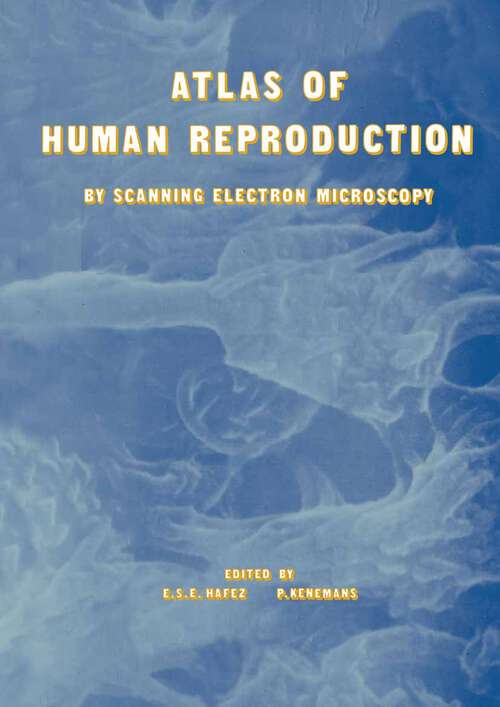 Book cover of Atlas of Human Reproduction: By Scanning Electron Microscopy (1982)