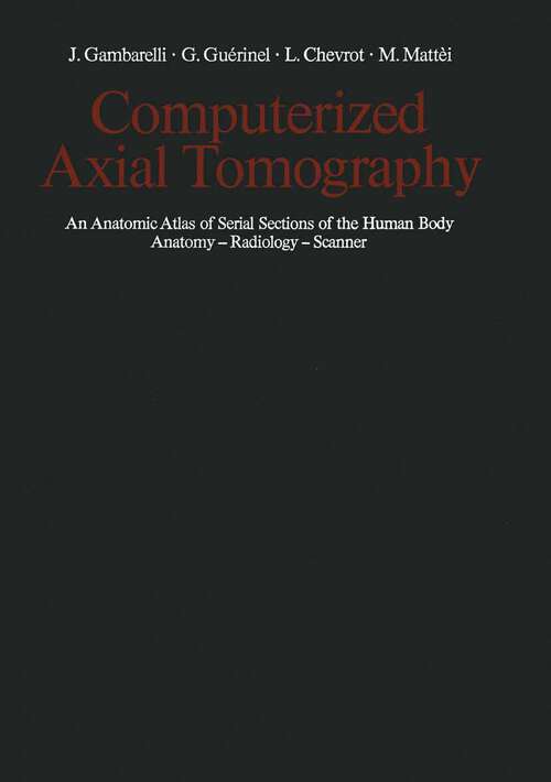 Book cover of Computerized Axial Tomography: An Anatomic Atlas of Serial Sections of the Human Body Anatomy — Radiology — Scanner (1977)