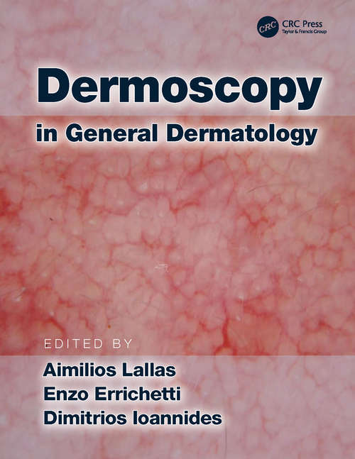 Book cover of Dermoscopy in General Dermatology