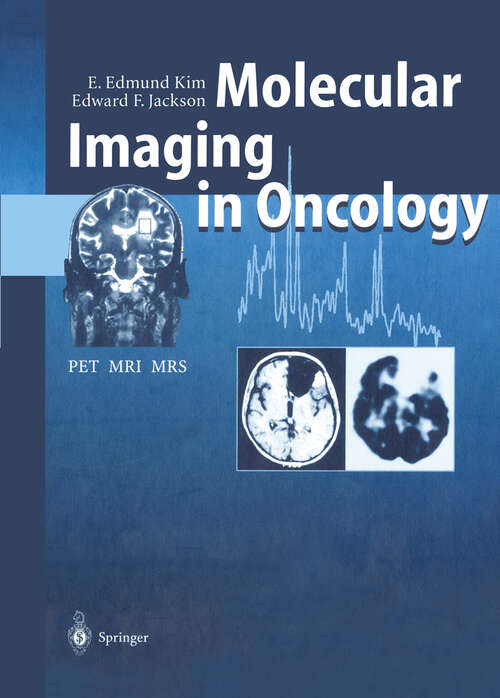 Book cover of Molecular Imaging in Oncology: PET, MRI, and MRS (1999)