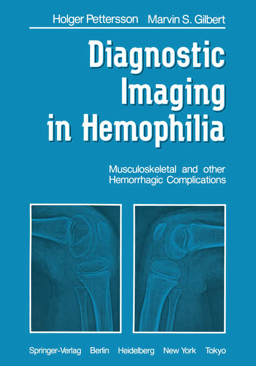 Book cover of Diagnostic Imaging in Hemophilia: Musculoskeletal and Other Hemorrhagic Complications (1985)