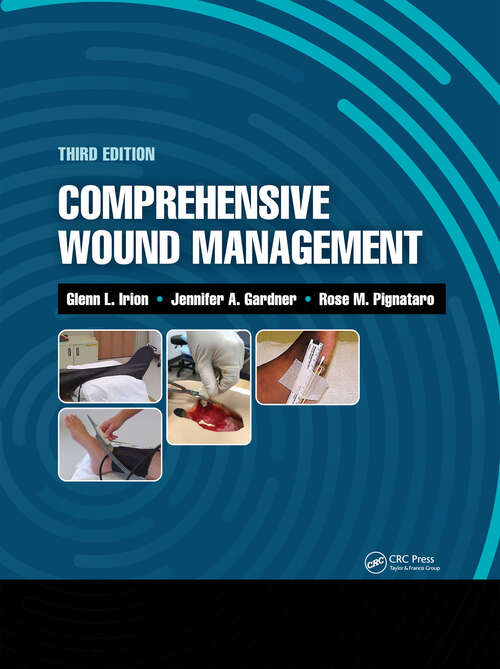 Book cover of Comprehensive Wound Management
