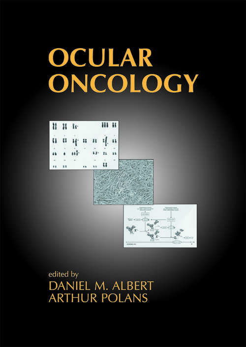 Book cover of Ocular Oncology